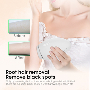 Dispositivo de Depilación IPL MLAY T21 para Uso Doméstico, Depiladora para Mujeres y Hombres con 500000 Flashes, Operación en Inglés - Product Image 6