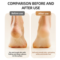 Nouveau Design Mini Portable Rechargeable Électrique Pied Polisseuse Peau Morte Meuleuse Soins Des Pieds Pédicure Outils Callus Remover