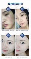 Nouveau modèle de masque à l'hydrogène pour les soins de la peau