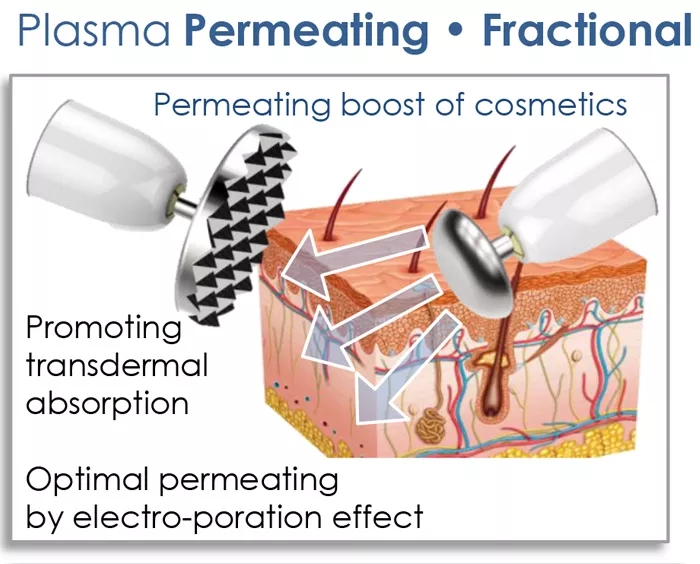 Plumas de la belleza del plamere del fibroblasto de la elevación del tratamiento de la piel de la pluma del plasma del uso médico del coreano