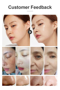 เครื่องไฮโดร 9-in-1 รุ่นใหม่ สำหรับทำความสะอาดผิวอย่างล้ำลึก ฟื้นฟูผิว ขาวกระจ่างใส <span class=keywords><strong>ลด</strong></span>เลือนริ้วรอย - Product Image 6