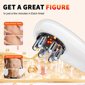 Masseur portatif électrique pour brûler les graisses, thérapie par <span class=keywords><strong>ventouses</strong></span>, appareil de massage pour points noirs, machine de remodelage corporel pour le ventre, la taille, les bras et les jambes - Product Image 5