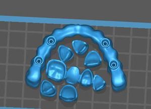 Imprimante 3D DLP 2K Top-Down pour la dentisterie, les bijoux, les cires céramiques, l'alumine, la zircone – Impression sans supports - Product Image 4