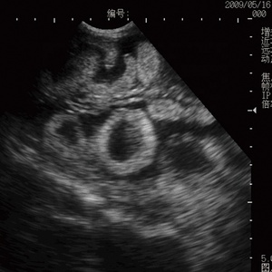 Alat USG Sapi Sektor Mekanik Digital Penuh KX-5100 Murah - Product Image 6