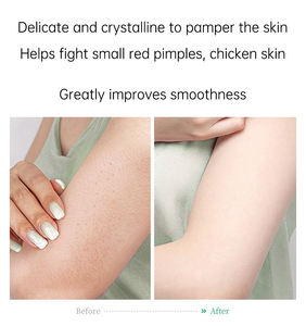 100% Natural Mejor vitamina C Niacinamida Loción Cuerpo Cuidado DE LA PIEL Cuidado de invierno Hidratante corporal - Product Image 2