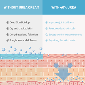 Crème pour les pieds et les mains en stock, crème réparatrice à 40% d'urée, anti-fissures, hydratante, améliorant la matité des articulations pour adultes, sans cruauté - Product Image 5