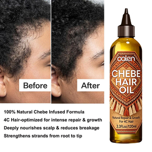 Crecimiento Rápido en 7 Días, Aceite Capilar de Manteca de Chebe Africana de Marca Privada Oalen Luxfume, Productos <span class=keywords><strong>para</strong></span> el Crecimiento <span class=keywords><strong>del</strong></span> Cabello con Aceite de Chebe, Anticaída - Product Image 4