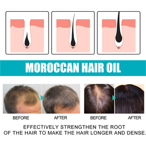 Smooth Dry Hair Moisturize and Smooth Hair Essential <b>Moroccan</b> <b>Oil</b> <b>Treatment</b> Hair Growth <b>Oil</b> for Black Women - Product Image 6