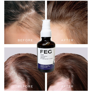 Spray <span class=keywords><strong>para</strong></span> la Caída del <span class=keywords><strong>Cabello</strong></span> Más Vendido, Marca Propia que Promueve el Crecimiento del Folículo Capilar y la Reparación del <span class=keywords><strong>Cabello</strong></span> - Product Image 4