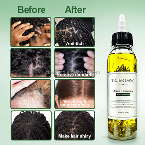 Sérum Capillaire Croissance des Cheveux à la Biotine et aux Plantes Marque Blanche Huile de Romarin Nourrissante Cuir Chevelu Antichute 120ml - Product Image 6