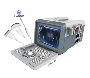 Lannx Urason P9 B/W Draagbare Echografie Machine Volledig Digitaal Ultrasoon Diagnostisch Beeldvormingssysteem Ziekenhuis Gebruik Usg Scanner