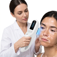 Appareil de photothérapie UVB portable Kernel KN 5000F 308 nm, thérapie par lumière ciblée 308 nm pour traiter le psoriasis localisé, le vitiligo