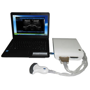 Système d'ultrason diagnostique portatif professionnel Ubox-10 - Product Image 4
