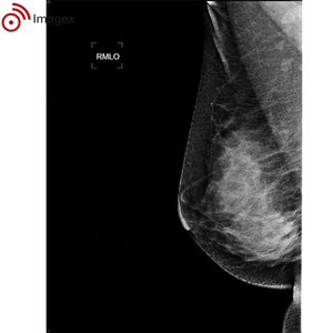 Mammographie numérique compatible CAO pour le dépistage vétérinaire et médical - Product Image 3