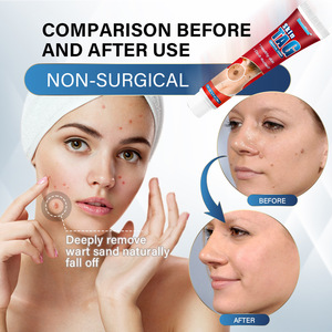 Wholesale Herbal Corn <strong>Cream</strong> for Body Care <strong>Skin</strong> <strong>Tags</strong> <strong>Remover</strong> and Mole <strong>Cream</strong> Effective Warts Ointment 20g - Product Image 3