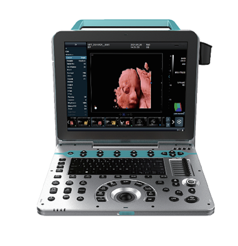 MT MEDICAL Otoscope Besdata Digital Medical