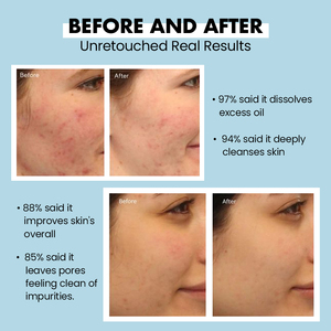 <span class=keywords><strong>Gel</strong></span> per la pulizia del viso organico coreano idratare delicatamente il trucco detergente per il viso con gelatina cremosa detergente per il viso - Product Image 5