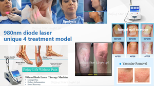 Il più nuovo dispositivo di rimozione della pigmentazione del fungo del chiodo di perdita di peso della penna al plasma di rimozione del ragno di fisioterapia di lipolisi del laser a diodi 980nm - Product Image 3