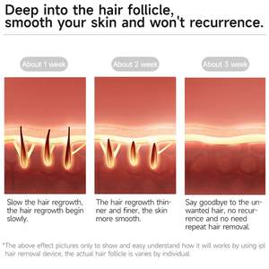 Para depiladora láser Mlay T14 para electrodomésticos de mujer con lente reemplazable 0,2 s refrigeración IPL removedor de <span class=keywords><strong>vello</strong></span> púbico indoloro - Product Image 6