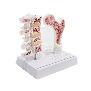 Modelo de Hueso de Osteoporosis, Modelo Anatómico de Esqueleto Humano en PVC para Escuelas - Vic <span class=keywords><strong>Science</strong></span> VIC-V45 - Product Image 2