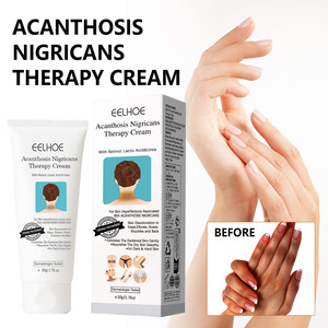 Superventas OEM ODM Melanina que disminuye la nutrición profunda Mejora la crema blanqueadora corporal de la piel de Blackthorn áspera - Product Image 2
