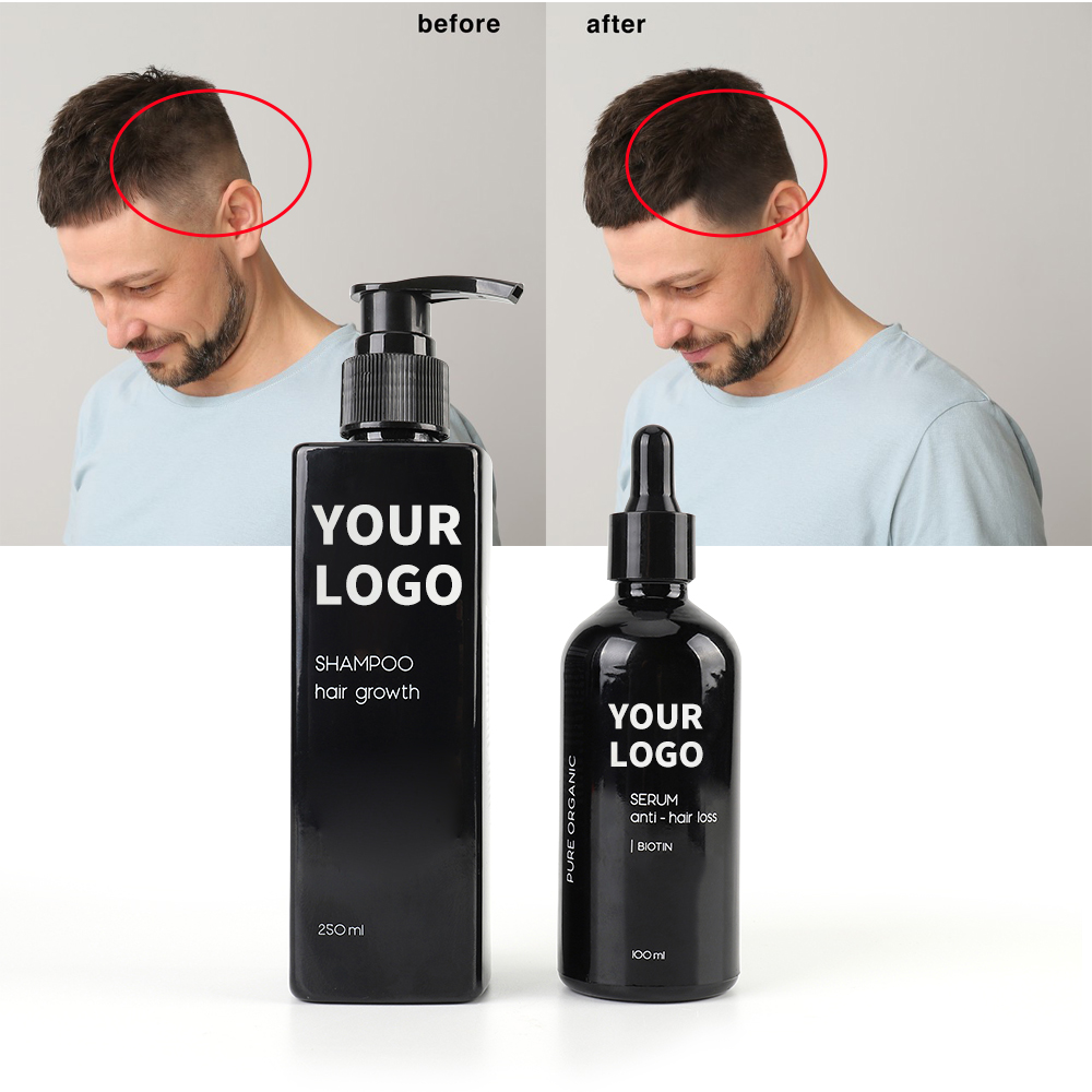 Высококачественное эфирное масло розмарина, сыворотка для роста волос, чистое натуральное масло розмарина