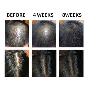 OEM cairan penumbuh rambut kondisioner minyak Revitalisasi rambut perawatan kulit kepala Anti rambut rontok perawatan esensi Serum penebal rambut - Product Image 6