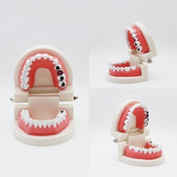 DM Dental Tooth Gems modelo educativo médico-paciente caries modelo de exhibición dentista enseñanza estudio