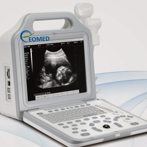 Échographe portable le moins cher, imagerie numérique complète, appareil à ultrasons pour la grossesse et la médecine vétérinaire BW21B - Product Image 3