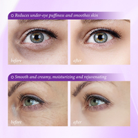 Crème Contour des Yeux Anti-Rides Active MOIKA 15g au Pro-Xylane, Ferment de Bifida et Hexapeptide-8 pour Cernes – Marque Blanche, Vente en Gros