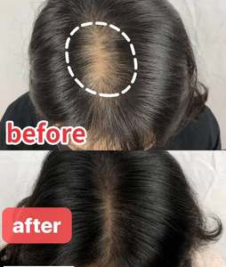 Huile de croissance des cheveux de marque privée bio formule japonaise traitement du cuir chevelu spray anti-chute pour la croissance des cheveux - Product Image 6