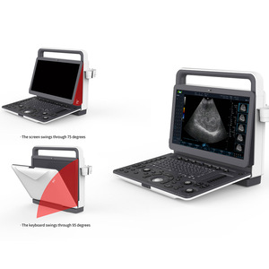 Sistem Diagnosa Ultrasonik Digital 15,6 Inci Satu Atap 3D 4D Color Doppler Mesin Ultrasound Portabel untuk Manusia atau Hewan - Product Image 6
