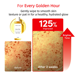Tónico Facial Iluminador con Vitamina C, Niacinamida, Ácido Tranexámico y Arbutina para Reducir Manchas Oscuras y Reparar la Barrera Cutánea OEM ODM - Product Image 5