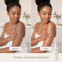 Vente en gros de lotion pour le corps éclaircissante HZBC VC - Acide ascorbique éthylique (non irritant), hydratant quotidien pour tous les types de peau