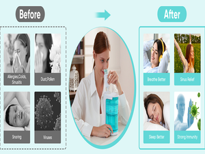 Irrigador Nasal SWE 2026 <span class=keywords><strong>GA</strong></span>-01 Moldeado por Inyección, Suave para su Nariz, Su Héroe para el Alivio de las Alergias - Product Image 4