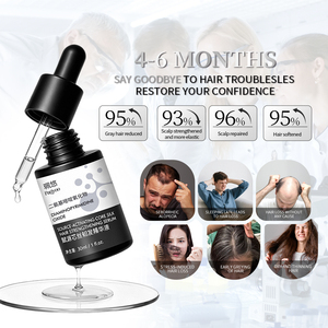 Suero Anticaída Más Vendido, Tratamientos para el Crecimiento del Cabello, Cuidado del Cuero Cabelludo, Venta al Por Mayor - Product Image 2