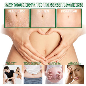 Jaysuing 7 giorni rimuovere smagliatura rimozione spray strie gravidum grasso stria growth rimuovendo idratante spray riparatore - Product Image 3