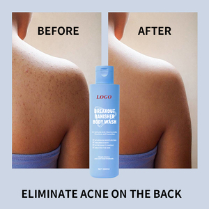 Gel Douche <span class=keywords><strong>Moussant</strong></span> <span class=keywords><strong>Bio</strong></span> Parfumé Rafraîchissant Coréen Personnalisé en Usine, <span class=keywords><strong>Meilleur</strong></span> Gluta Éclaircissant, Hydratant, Nettoyant en Profondeur et Contrôlant le Sébum pour le Corps - Product Image 5