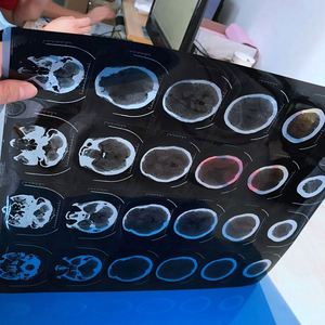 Processore di pellicole radiografiche per uso medico ad alimentazione elettrica per apparecchiature radiologiche - Product Image 6