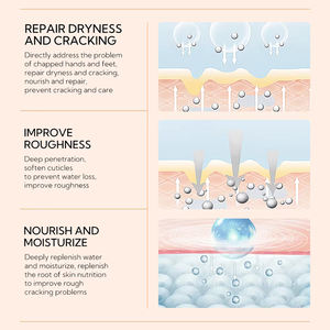 Crema Exfoliante para Pies de Marca Privada, Loción Corporal Hidratante para Grietas, Crema Reparadora para Pies con Urea Blanqueadora - Product Image 4