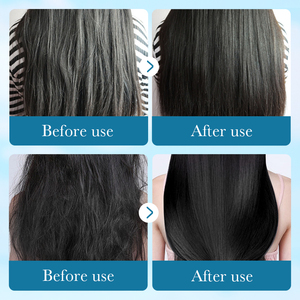 Champú y Acondicionador para el cuidado del cabello, anticaspa, alivia la picazón, aloe vera - Product Image 6