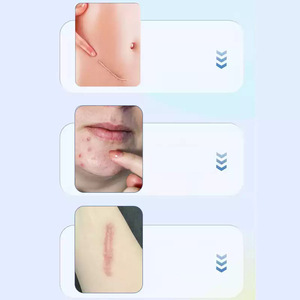 ไฮนอท เมดิคอล สการ์ เจล 15 กรัม สำหรับแผลไฟไหม้ น้ำร้อนลวก แผลผ่าตัด รอยแผลเป็นจากสิว - Product Image 2