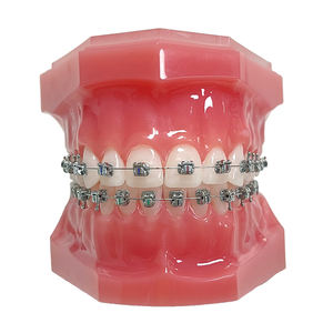 Suportes ortodônticos dentais Suportes auto-ligantes passivos para fábrica fabricação 2G - Product Image 6