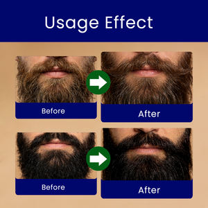 QBEKA Huile de Jojoba Biologique et Huile d'Argan de Haute Qualité pour Hommes - Hydratant <span class=keywords><strong>Barbe</strong></span> - Soulage les Démangeaisons et Adoucit la <span class=keywords><strong>Barbe</strong></span> - Product Image 6