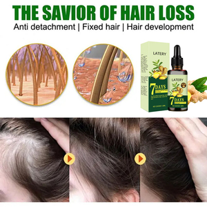 Grande Vente Huile de Croissance Capillaire Rapide en 7 Jours, Traitement Anti-Chute au Gingembre, <span class=keywords><strong>Sérum</strong></span> Fortifiant et Nourrissant pour le Cuir Chevelu et la Repousse des <span class=keywords><strong>Cheveux</strong></span> - Product Image 4