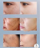 Crème anti-âge raffermissante et éclaircissante de très haute qualité pour le soin de la peau du visage, élimination des taches de rousseur
