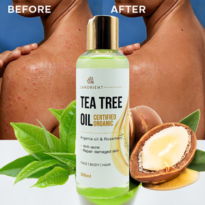 Huile Essentielle Pure Coréenne de Luxe à Marque Blanche <span class=keywords><strong>avec</strong></span> Carotte et Vitamine E pour Nourrir et Corriger les Taches Brunes - Product Image 1