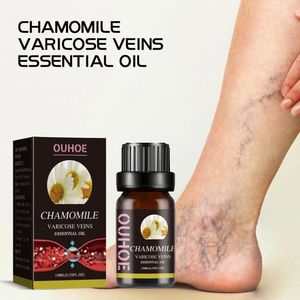 OUHOE Vente en gros OEM Soin de la peau Réparation des <span class=keywords><strong>varices</strong></span> Sérum <span class=keywords><strong>pour</strong></span> éliminer les <span class=keywords><strong>varices</strong></span> Traitement des <span class=keywords><strong>varices</strong></span> <span class=keywords><strong>Huile</strong></span> <span class=keywords><strong>essentielle</strong></span> de camomille 10 ml - Product Image 5