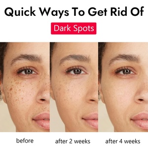 TXA+Niacinamide Capsule <strong>Cream</strong> <strong>Face</strong> Brightening Hydration Reduce Dark Spot <strong>Korean</strong> Skincare <strong>Cream</strong> for Uneven Skin Tone - Product Image 5