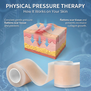 แผ่นซิลิโคนเจลปิดแผล ปี 2026 เทปปิด<span class=keywords><strong>แผล</strong></span>แบบไวต่อแรงกด ปิดแผล ป้องกันรอยขีดข่วน แผ่นปิดแผลสำหรับเล่นกีฬา ผ้าเนื้อยืด สีผิว - Product Image 4